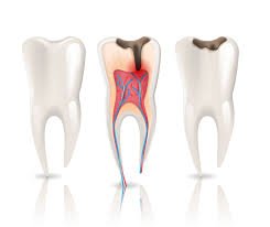 Best inexpensive dental insurance